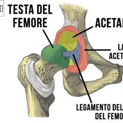 Anatomia dell'anca: testa del femore, acetabolo e labbro acetabolare. Il conflitto femoro-acetabolare può causare dolore.
