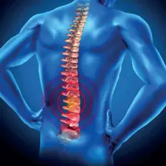 La vertebroplastica cos'è? Un'immagine che mostra una colonna vertebrale con un'area di dolore evidenziata in rosso, suggerendo un intervento per alleviare il mal di schiena.