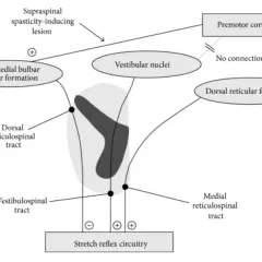 Schema che illustra la spasticità indotta da lesioni sovraspinali, con percorsi che influenzano il circuito del riflesso da stiramento, rilevante per la scala Ashworth.