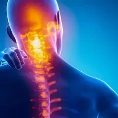 Dolore al collo e ai muscoli: i **trigger point cervicale sintomi** sono evidenziati da un'area infiammata nella colonna vertebrale.