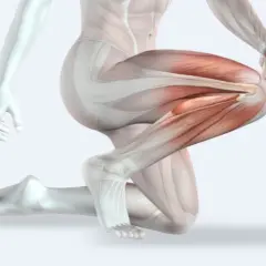 Dettaglio anatomico della muscolatura della gamba, evidenziata la bandelletta ileotibiale in tensione.