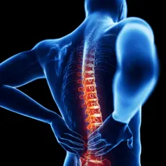 Dolore alla schiena, evidenziato da un'area rossa sulla colonna vertebrale. Possibili schiacciamento vertebre rimedi.
