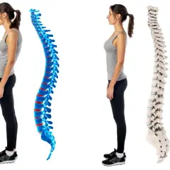 Postura scorretta vs. colonna vertebrale dritta. La donna a sinistra ha una postura curva, mentre quella a destra mostra una colonna vertebrale allineata e sana.