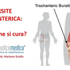 Illustrazione anatomica della borsite trocanterica, con indicazione della zona interessata e del centro di riabilitazione Modicamedica.