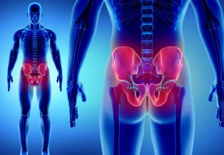 Anatomia del bacino femminile, con le creste iliache evidenziate in rosso.