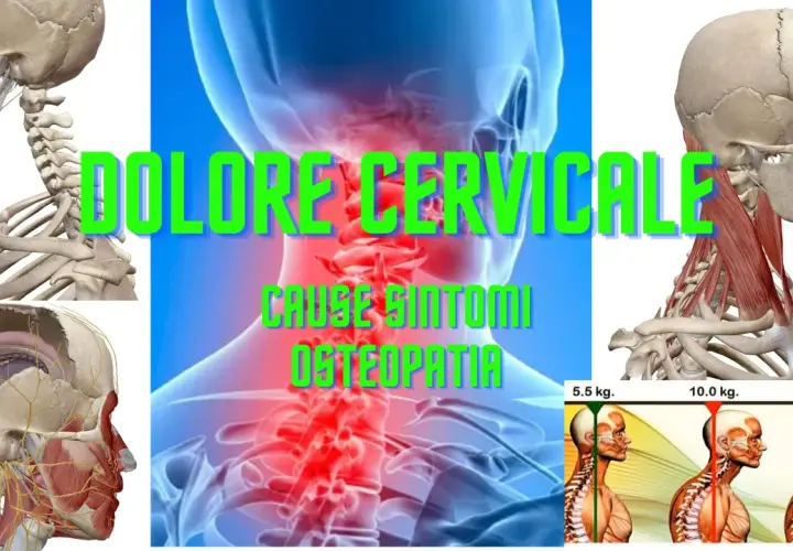 Anatomia del collo con focus su osteocondrosi cervicale. Immagini di scheletri, muscoli e vertebre evidenziano il dolore cervicale e le sue cause.