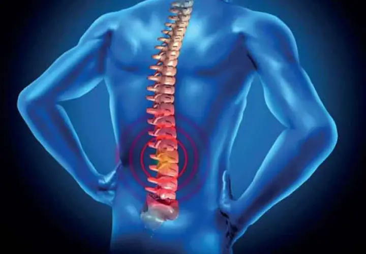 La vertebroplastica cos'è? Un'immagine che mostra una colonna vertebrale con un'area di dolore evidenziata in rosso, suggerendo un intervento per alleviare il mal di schiena.
