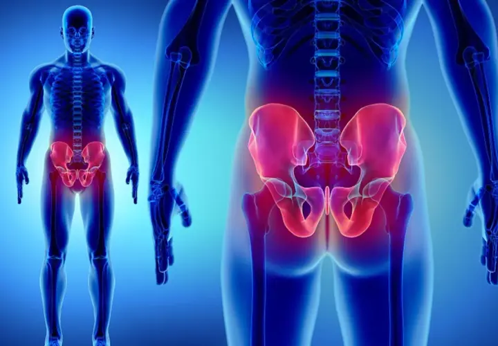 Illustrazione anatomica del bacino evidenziato in rosso, con focus sulla frattura osso sacro terapia.