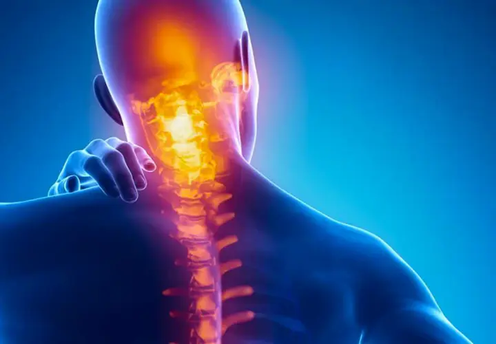 Dolore al collo e ai muscoli: i **trigger point cervicale sintomi** sono evidenziati da un'area infiammata nella colonna vertebrale.