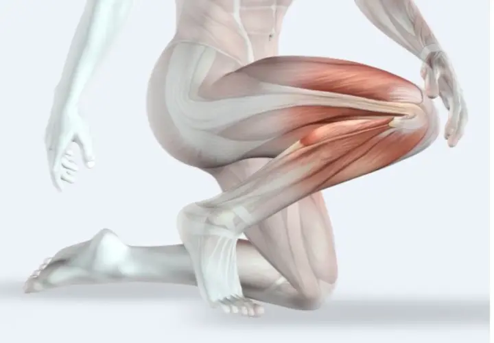 Dettaglio anatomico della muscolatura della gamba, evidenziata la bandelletta ileotibiale in tensione.