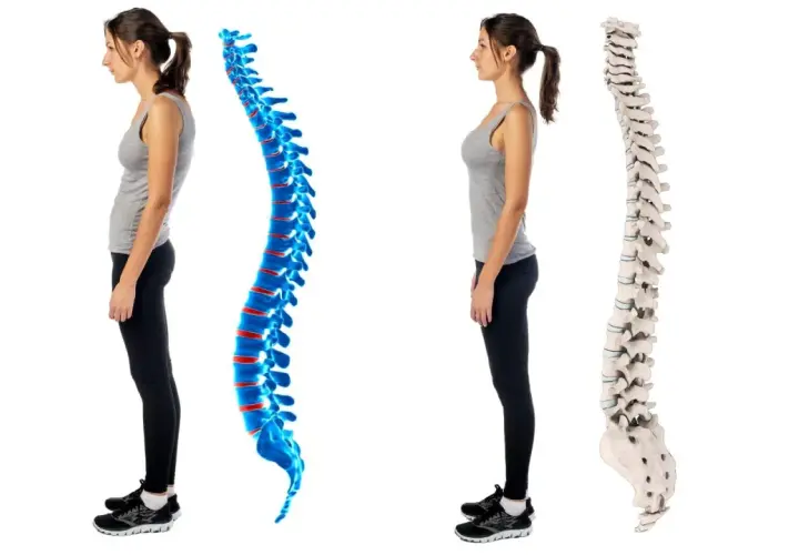 Postura scorretta vs. colonna vertebrale dritta. La donna a sinistra ha una postura curva, mentre quella a destra mostra una colonna vertebrale allineata e sana.