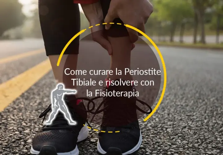 Runner con dolore alla tibia, che indica come curare la periostite tibiale con la fisioterapia.