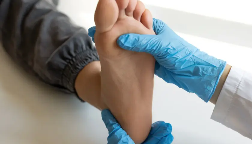 Mani con guanti blu esaminano la pianta del piede, valutando la metatarsalgia plantare.