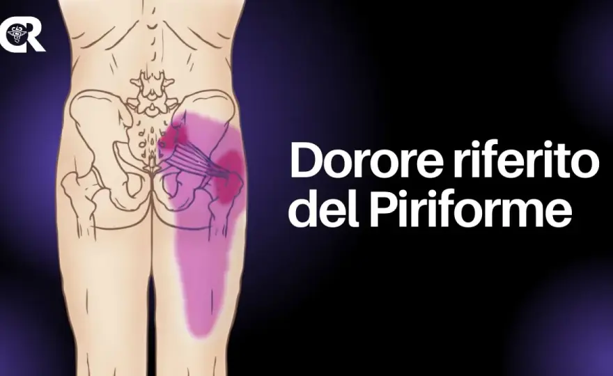 Test piriforme - come si svolge e come interpretarlo