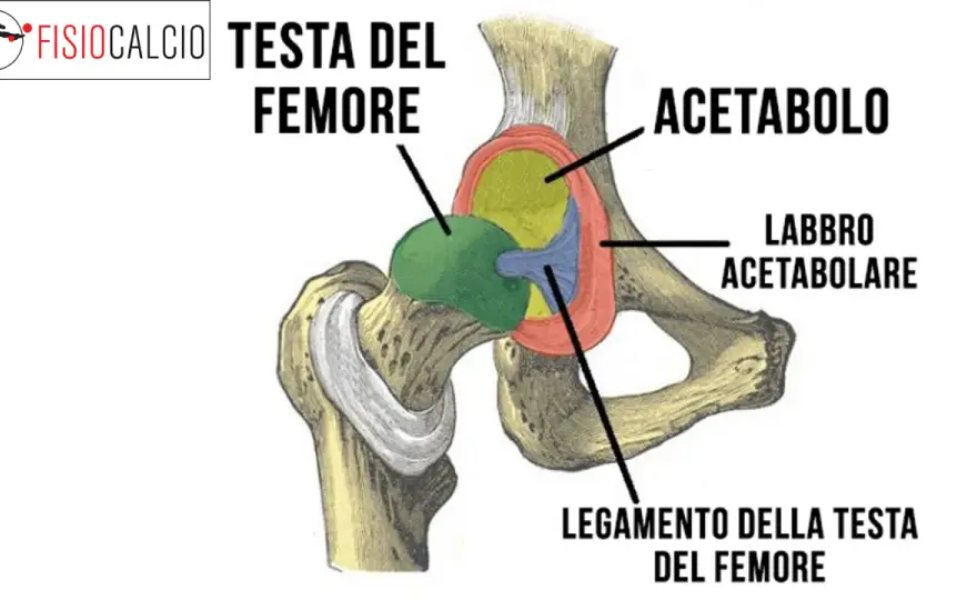 Conflitto femoro-acetabolare - sintomi e cosa fare