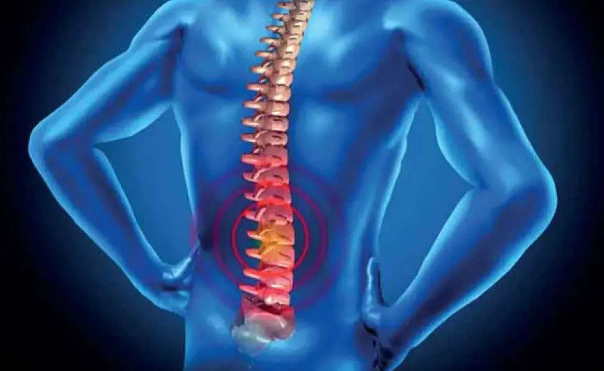 Vertebroplastica, quando serve e cosa aspettarsi