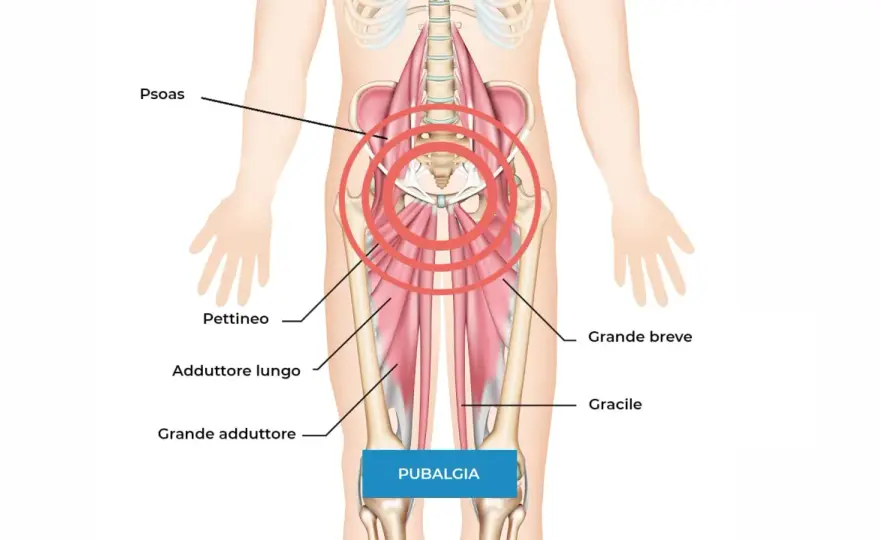 Pubalgia, cosa fare per recuperare e tornare allo sport