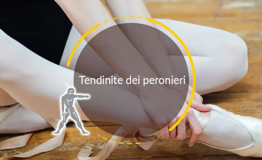 Os peroneum doloroso - sintomi, diagnosi e cure