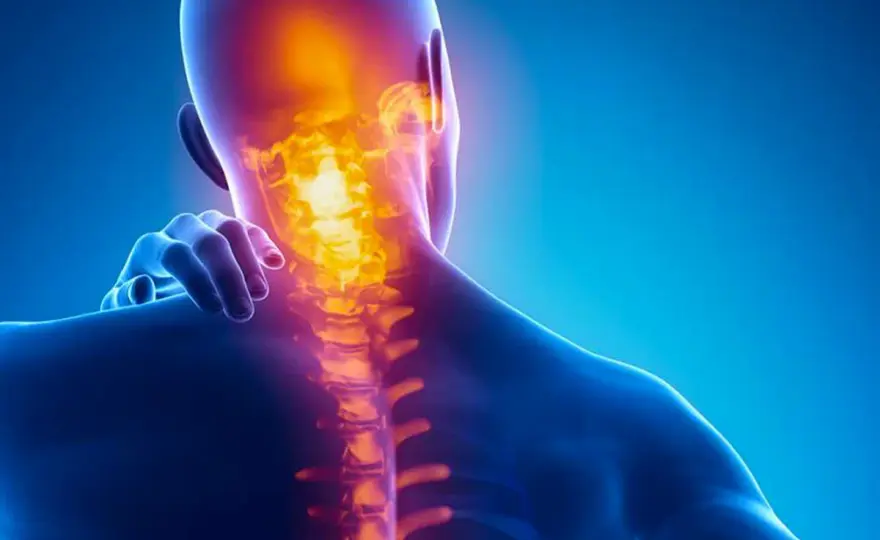 Trigger point cervicale - sintomi, cause e cosa fare