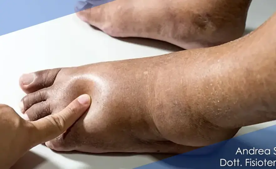 Imbibizione edematosa - cosa significa e quando preoccuparsi