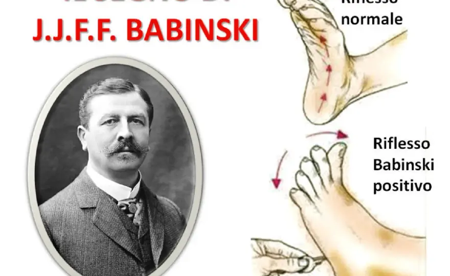 Riflesso di Babinski, come si interpreta negli adulti e nei bambini