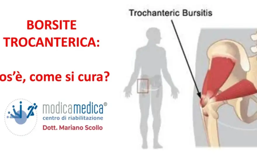 Borsite trocanterica, cosa fare per ridurre il dolore