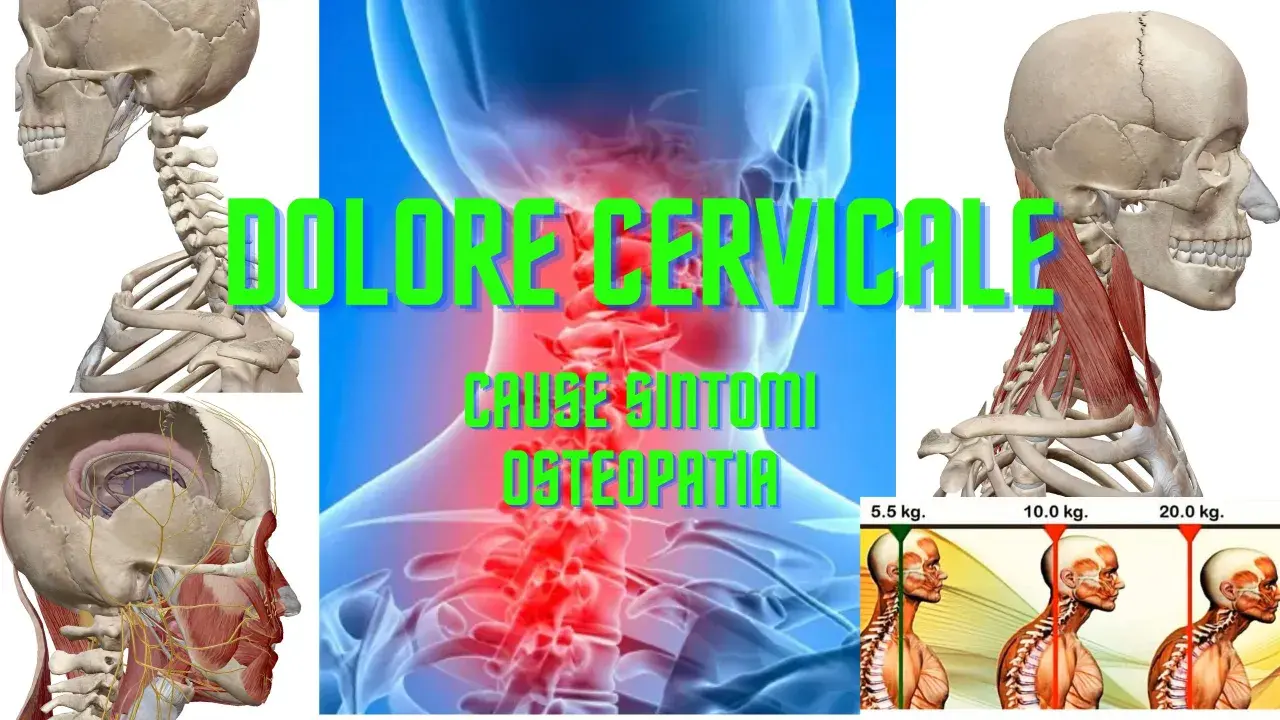 Anatomia del collo con focus su osteocondrosi cervicale. Immagini di scheletri, muscoli e vertebre evidenziano il dolore cervicale e le sue cause.