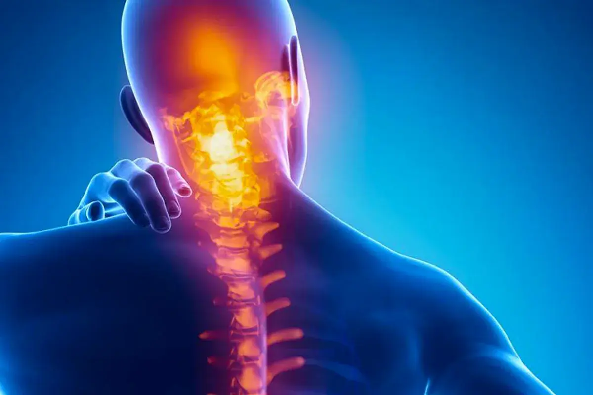 Dolore al collo e ai muscoli: i **trigger point cervicale sintomi** sono evidenziati da un'area infiammata nella colonna vertebrale.