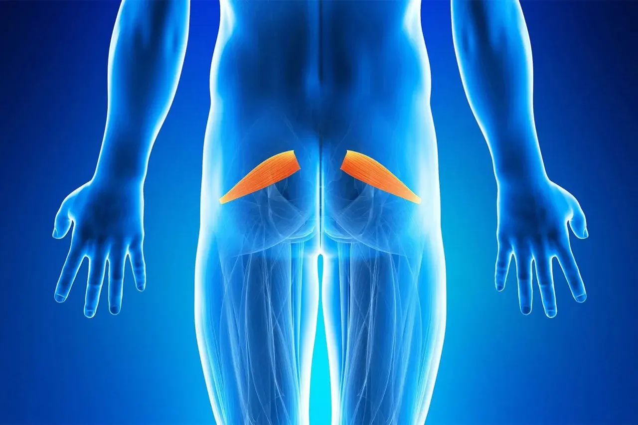 Muscolo piriforme evidenziato in arancione. L'infiammazione del piriforme può causare sintomi simili alla sciatica.