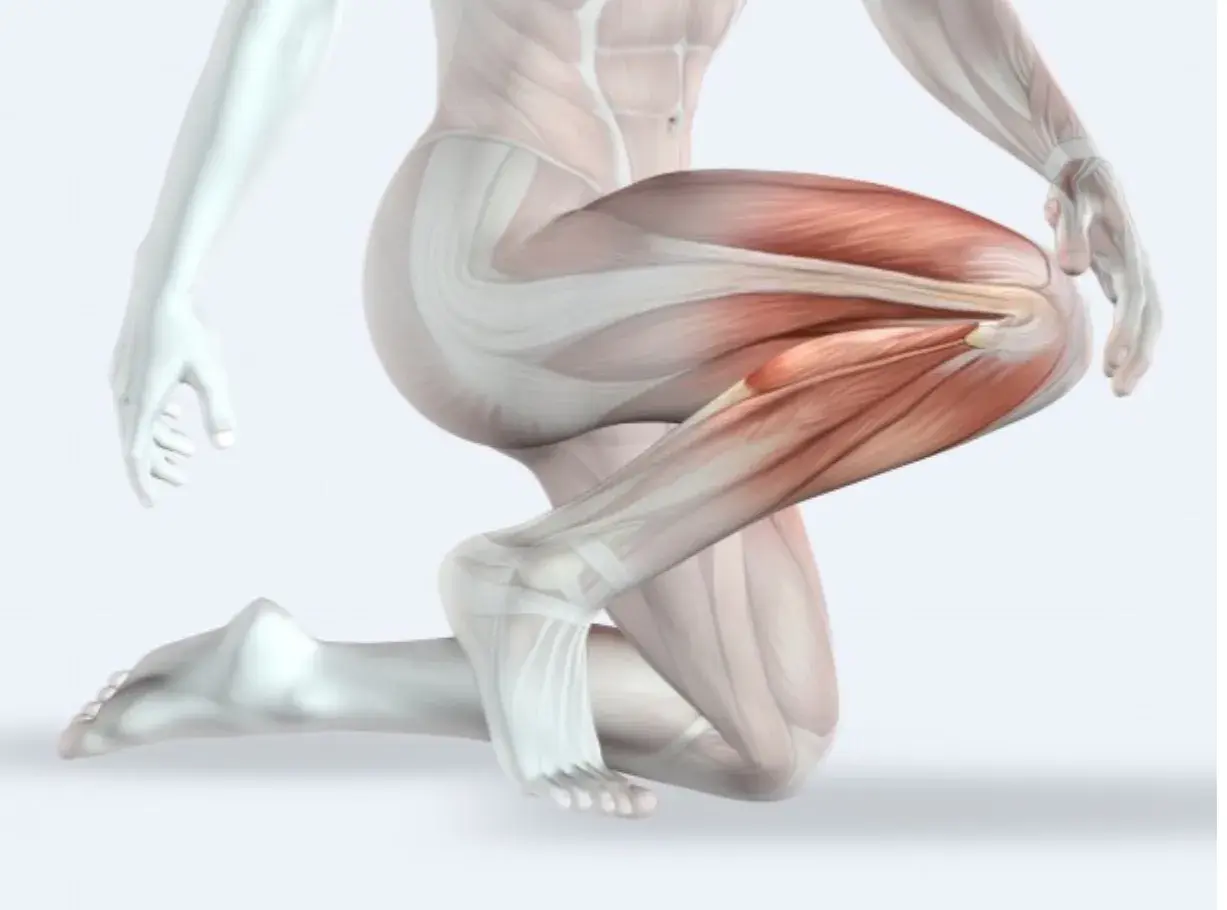 Dettaglio anatomico della muscolatura della gamba, evidenziata la bandelletta ileotibiale in tensione.