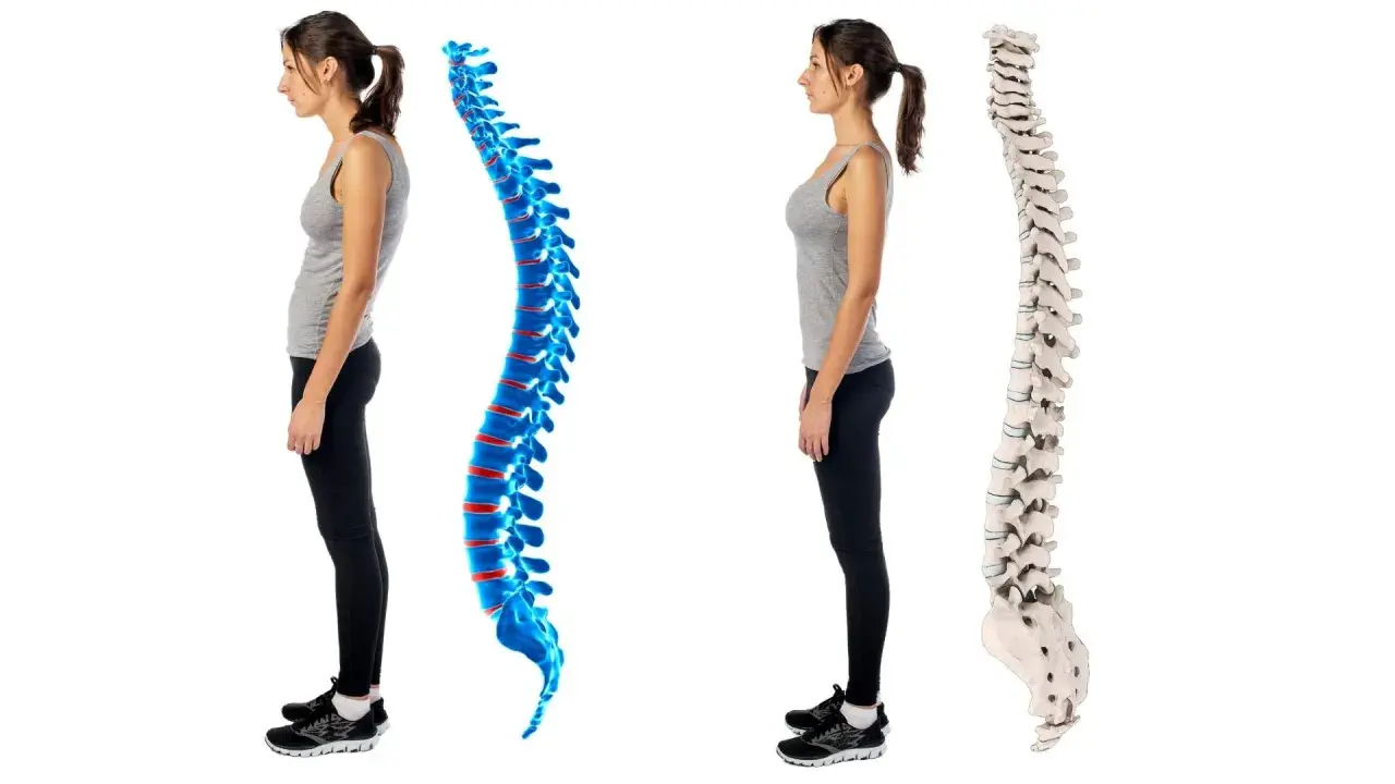 Postura scorretta vs. colonna vertebrale dritta. La donna a sinistra ha una postura curva, mentre quella a destra mostra una colonna vertebrale allineata e sana.