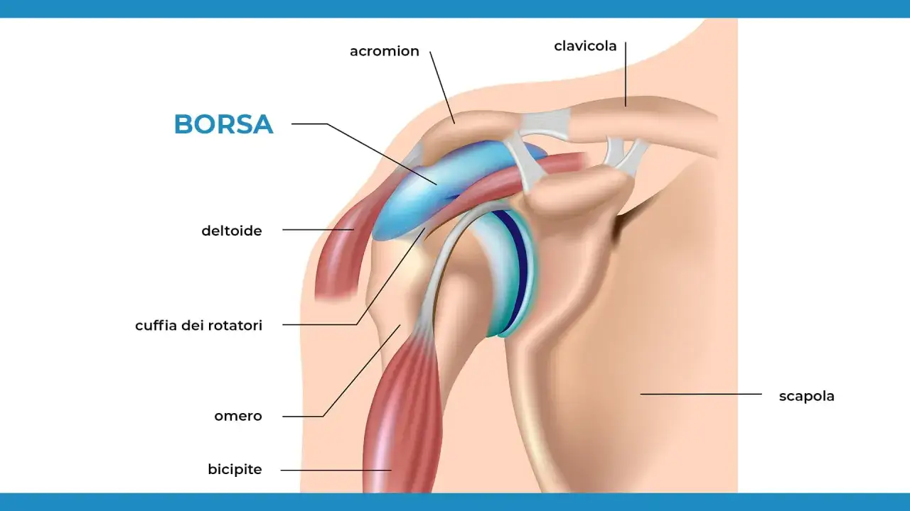 Illustrazione anatomica della spalla che mostra la borsa, un cuscinetto di liquido che riduce l'attrito. Spiega cos'è la borsite.