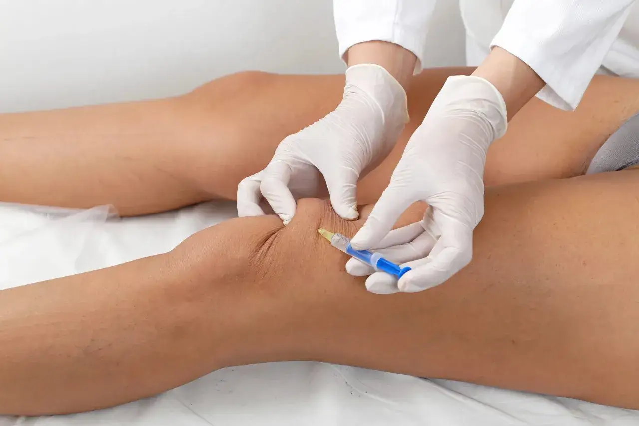 Iniezione al ginocchio per alleviare i dolori muscolari dopo cortisone. Mani con guanti bianchi e siringa blu.
