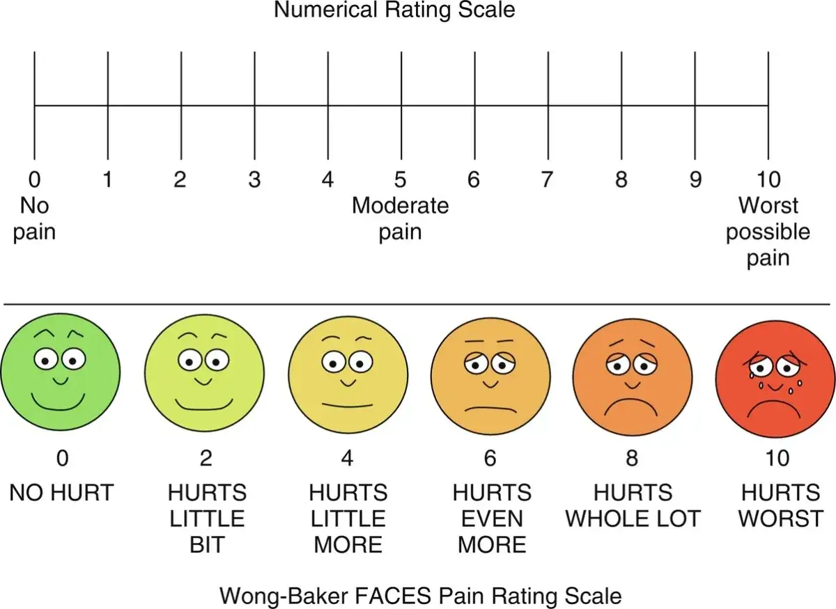 Scala NRS: da 0 (nessun dolore) a 10 (dolore peggiore). Le faccine mostrano l'intensit&agrave; del dolore.
