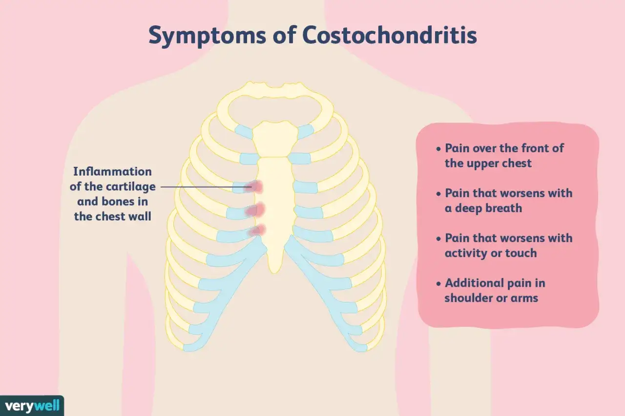 Illustrazione della gabbia toracica che mostra i costocondrite sintomi: infiammazione della cartilagine, dolore al petto, peggioramento con respiro profondo o attività.